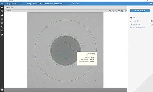 Detected Anomaly Information